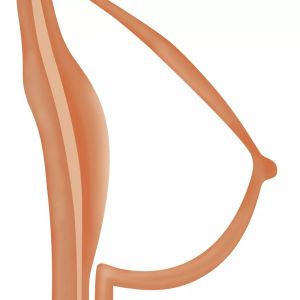 option breast hollow