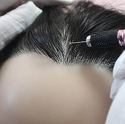 Implant Real Human Hair